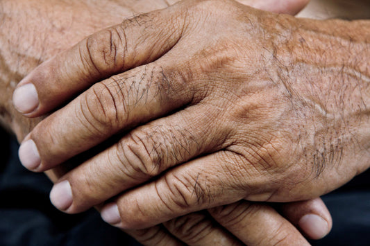 Why Liquid Oil Is the Best Topical Treatment for Arthritis Pain (And What Creams Get Wrong)